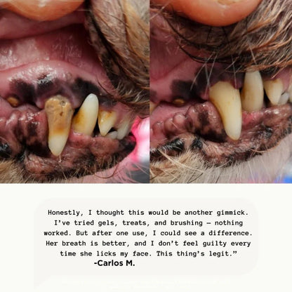 Ultradental Cleaning Kit